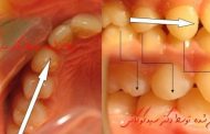 اصلاح نامرتبی دندان ها و روابط نامناسب دندان ها